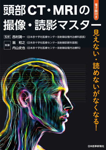 頭部CT・MRIの撮像・読影マスター