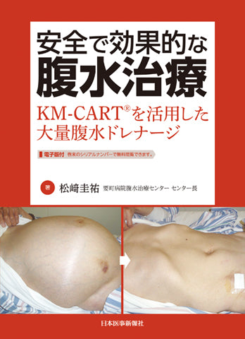 安全で効果的な腹水治療