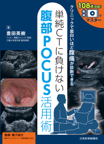 単純CTに負けない腹部POCUS活用術