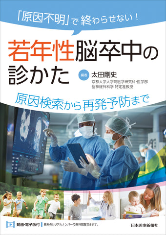 「原因不明」で終わらせない！　若年性脳卒中の診かた