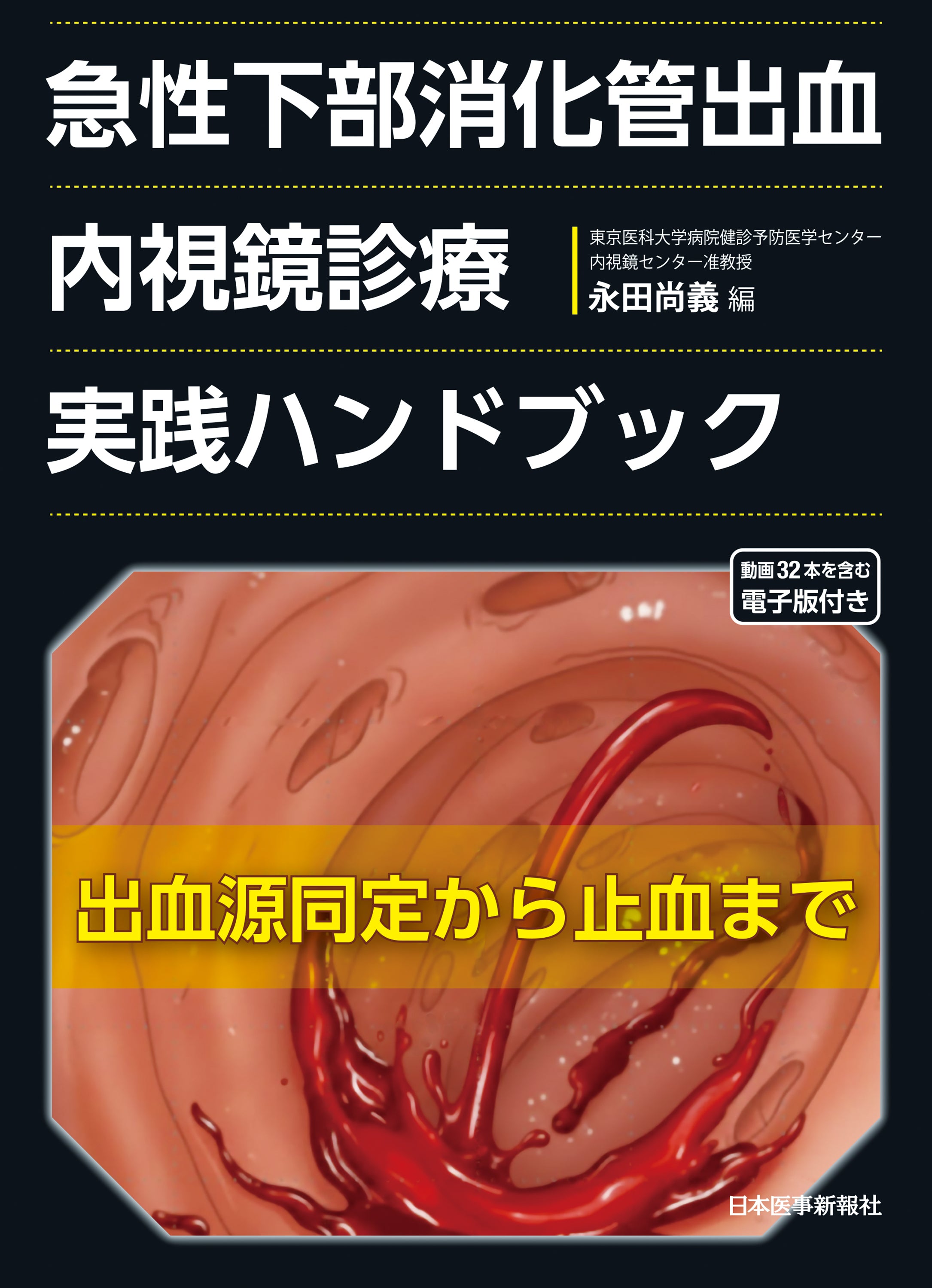 急性下部消化管出血 内視鏡診療実践ハンドブック