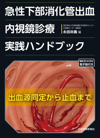 急性下部消化管出血 内視鏡診療実践ハンドブック – 日本医事新報社