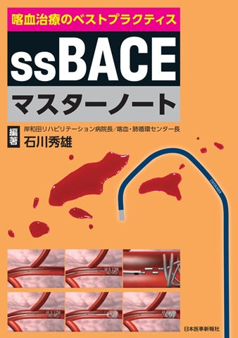 ssBACEマスターノート