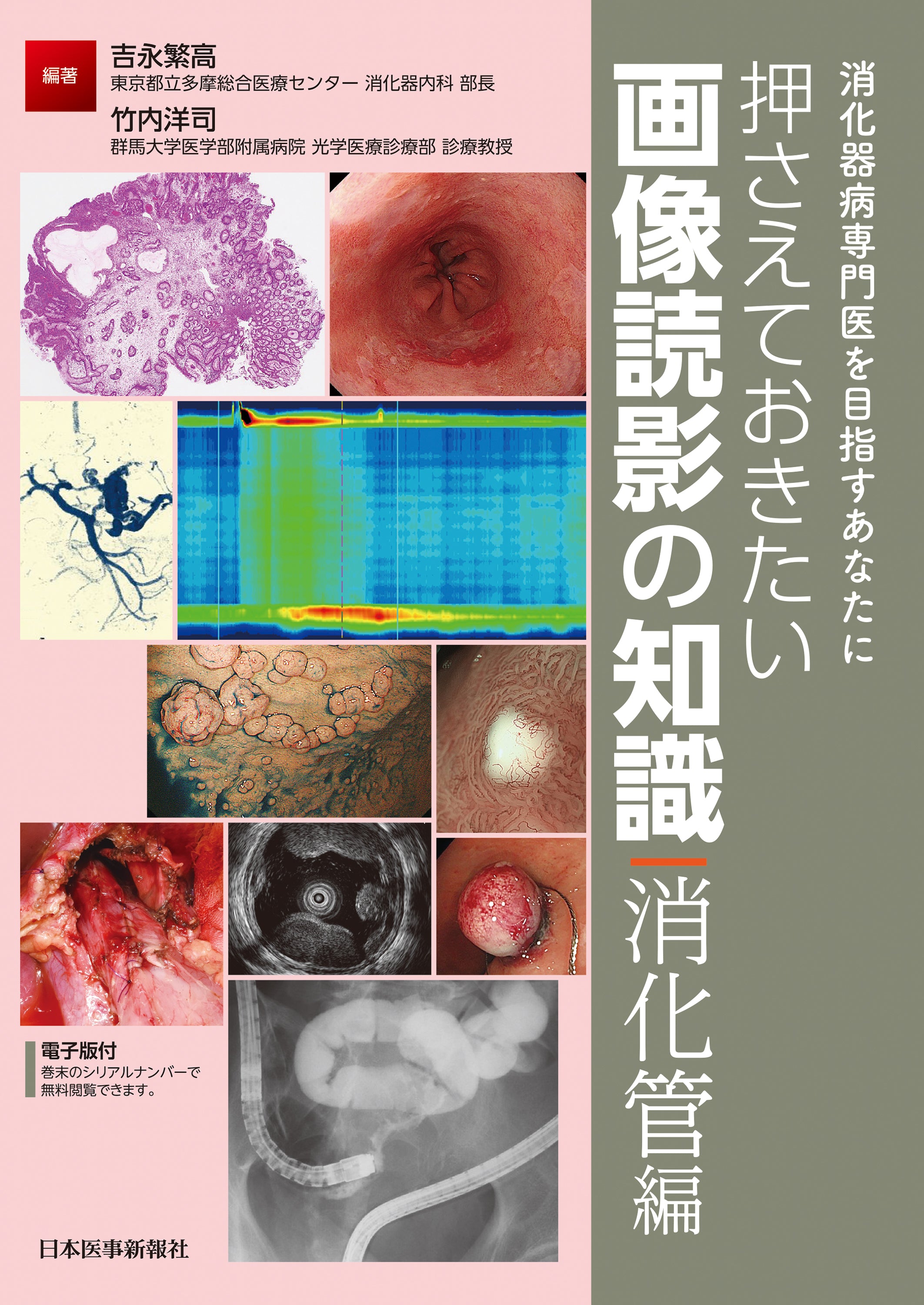 押さえておきたい画像読影の知識　消化管編