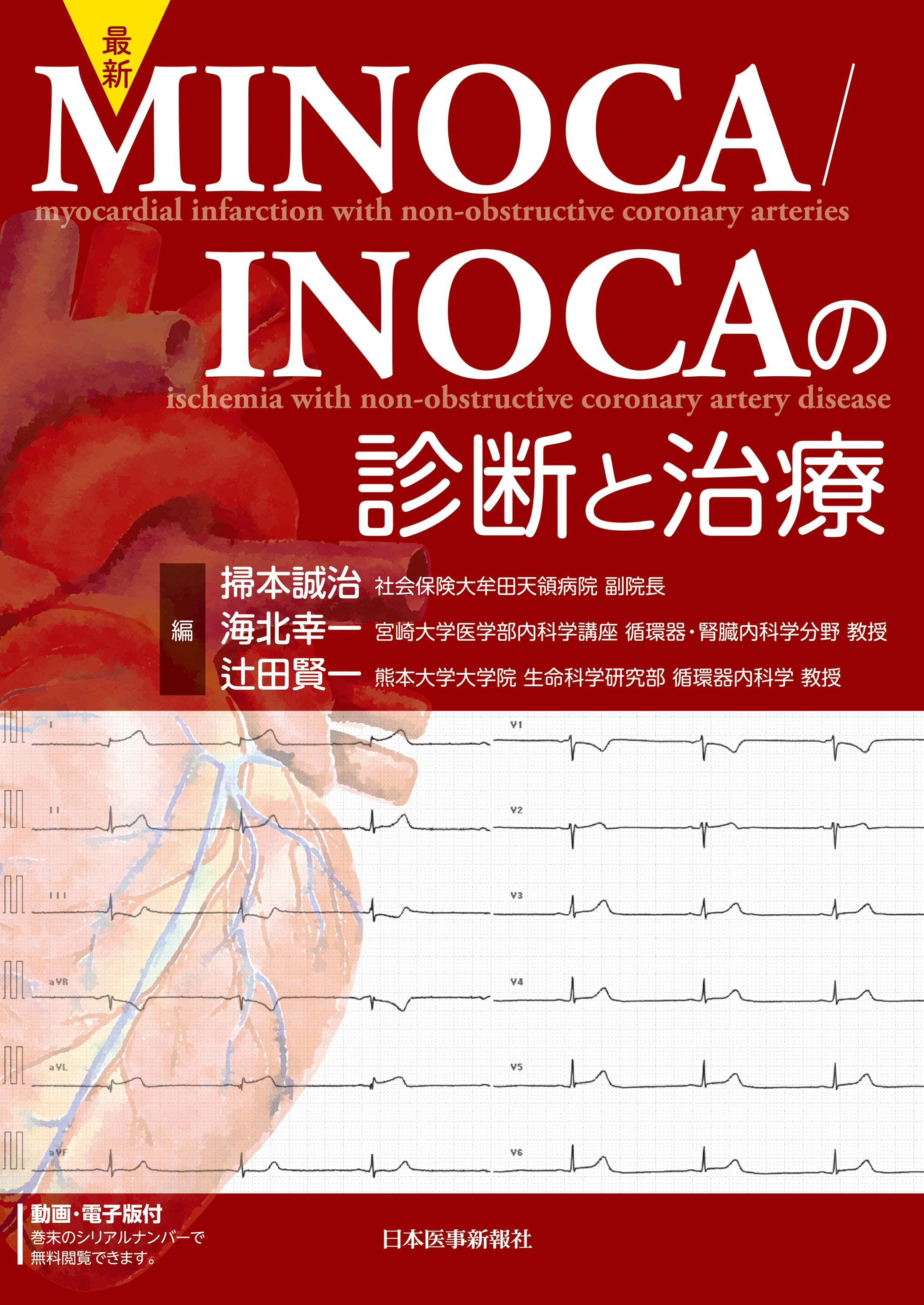 最新 MINOCA／INOCAの診断と治療
