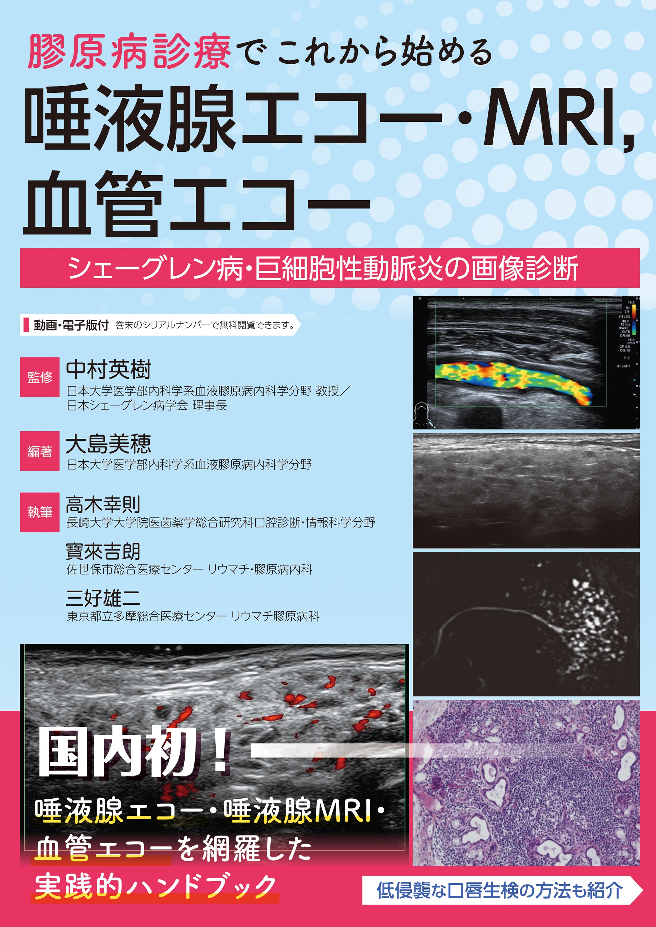 膠原病診療でこれからはじめる　唾液腺エコー・MRI，血管エコー