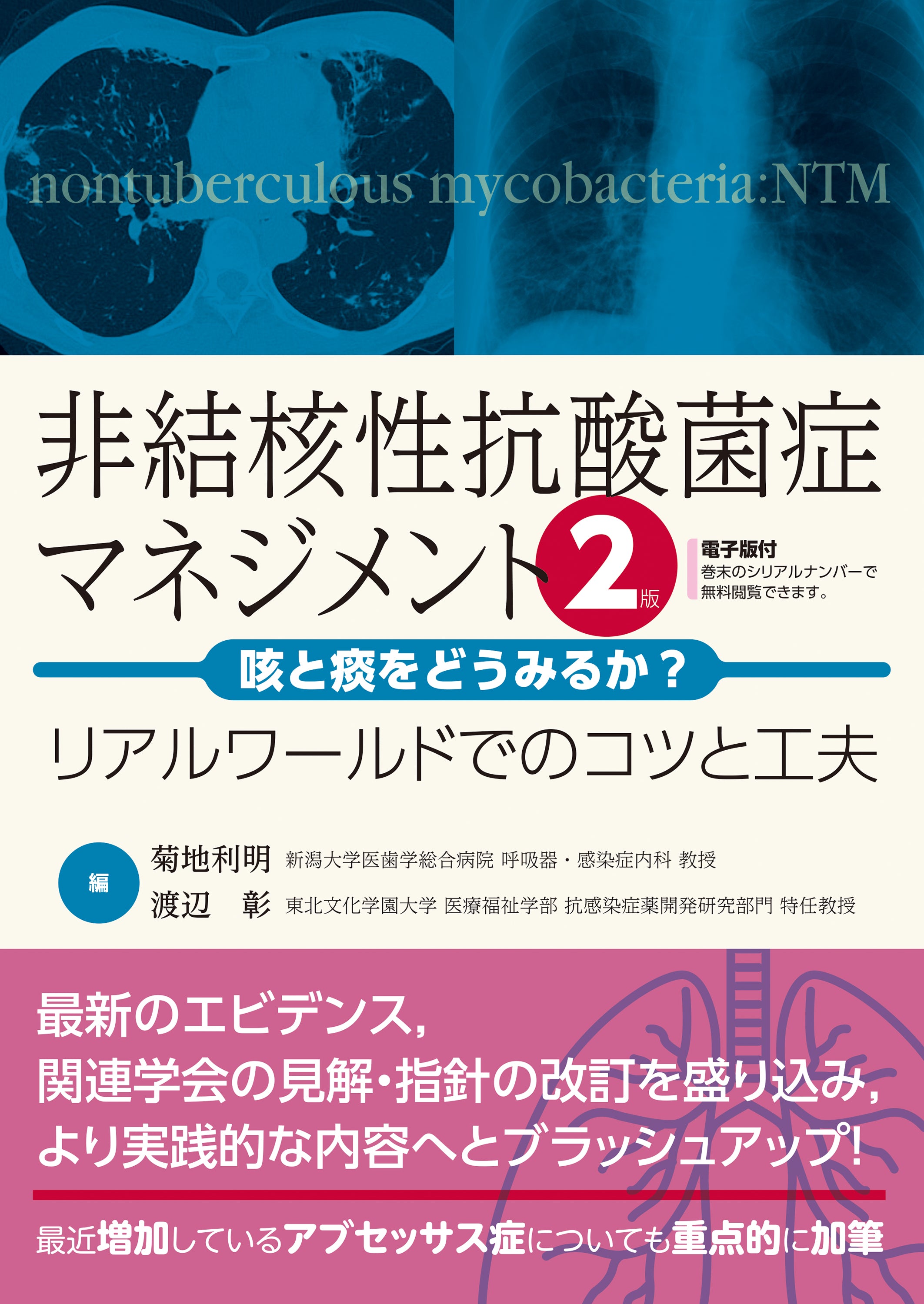 非結核性抗酸菌症マネジメント─咳と痰をどうみるか？ リアルワールドでのコツと工夫　第2版