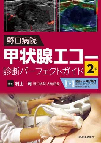 野口病院 甲状腺エコー診断パーフェクトガイド 第2版【動画を含む電子版付】