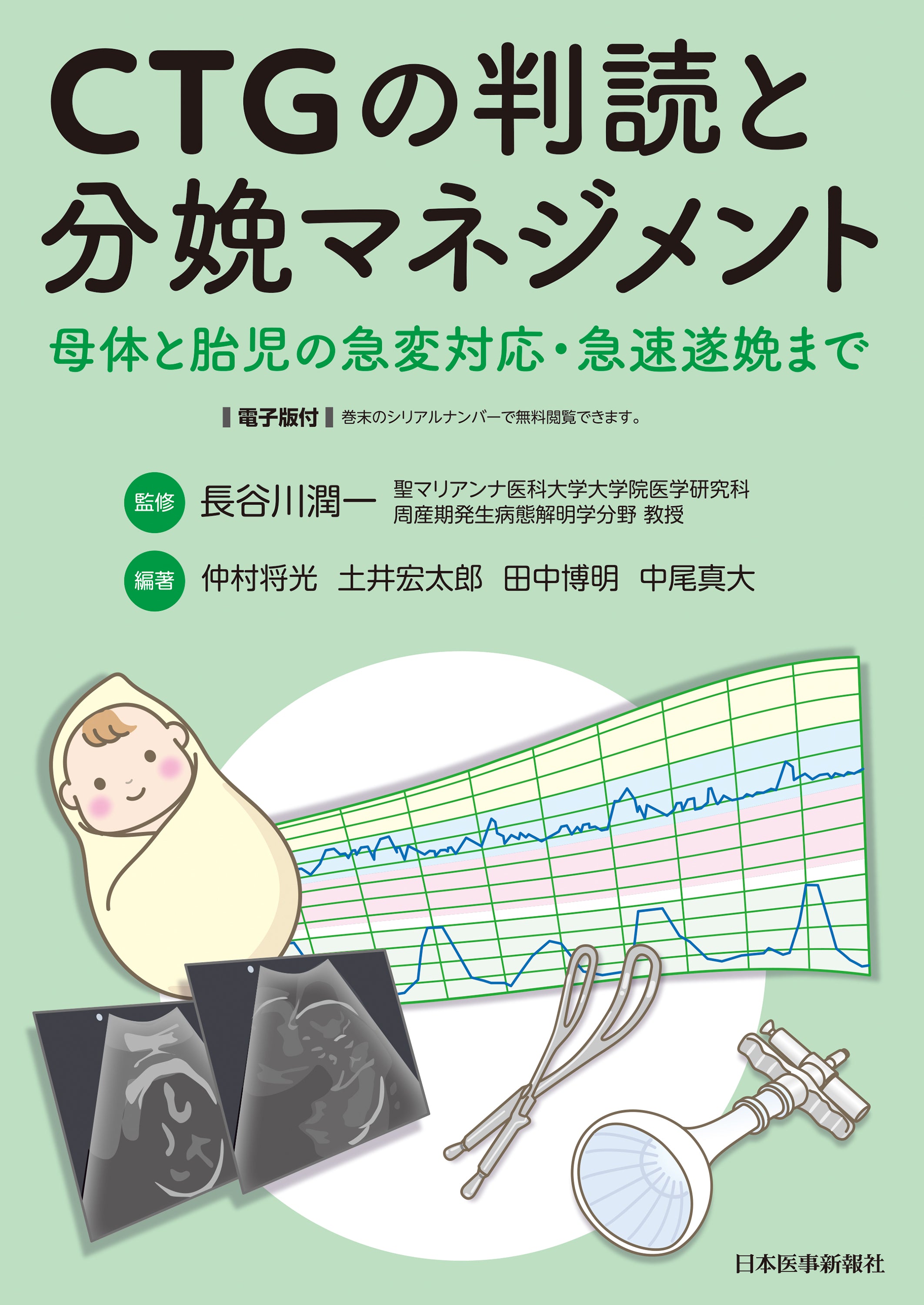 CTGの判読と分娩マネジメント