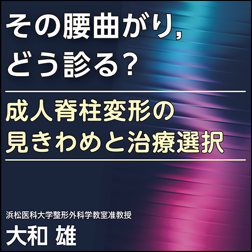 その腰曲がり，どう診る？〈成人脊柱変形の見きわめと治療選択〉