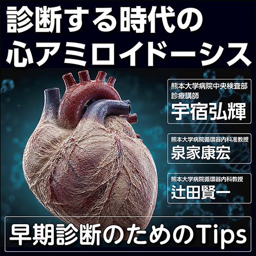 診断する時代の心アミロイドーシス〈早期診断のためのTips〉