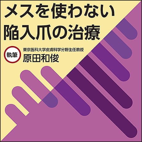 メスを使わない陥入爪の治療