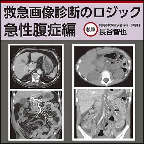救急画像診断のロジック〜急性腹症編
