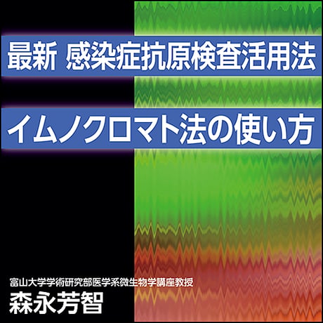 〈最新〉感染症抗原検査活用法〜イムノクロマト法の使い方