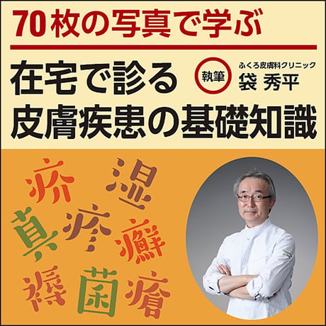 70枚の写真で学ぶ 在宅で診る皮膚疾患の基礎知識