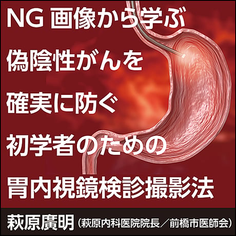 【NG画像から学ぶ】偽陰性がんを確実に防ぐ初学者のための胃内視鏡検診撮影法