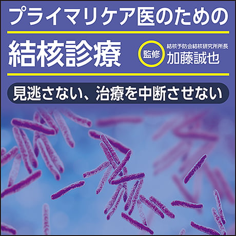 プライマリケア医のための結核診療〜見逃さない、治療を中断させない