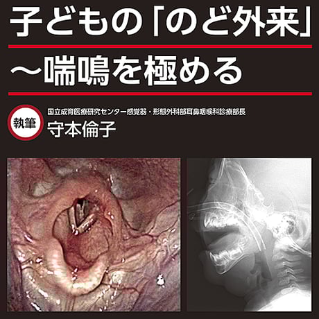 子どもの「のど外来」〜喘鳴を極める