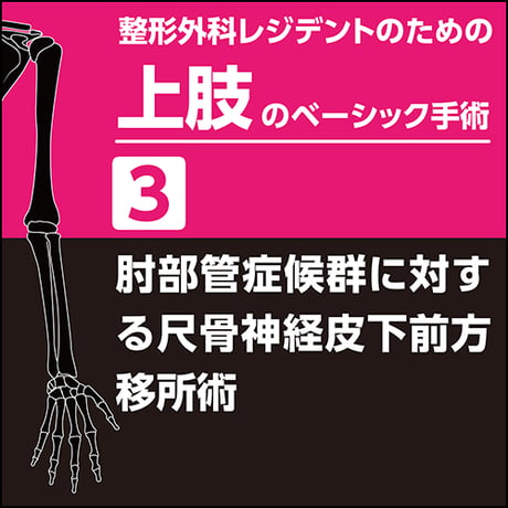 整形外科レジデントのための上肢のベーシック手術3　肘部管症候群に対する尺骨神経皮下前方移所術（PDF版）