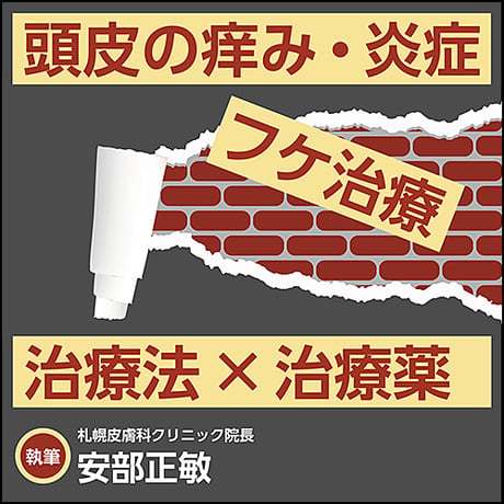 頭皮の痒み・炎症・フケ治療〜治療法×治療薬