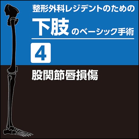 整形外科レジデントのための下肢のベーシック手術4　股関節唇損傷（PDF版）
