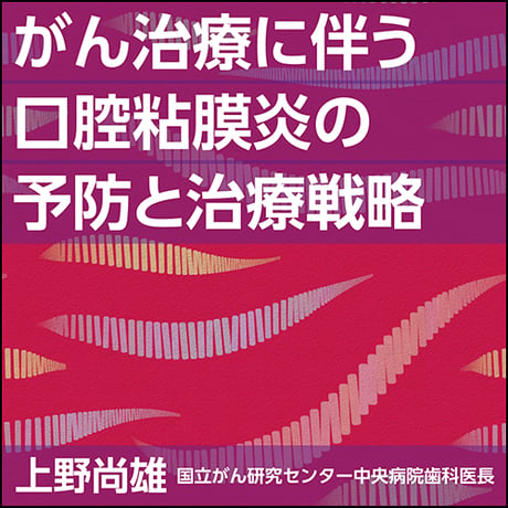 がん治療に伴う口腔粘膜炎の予防と治療戦略