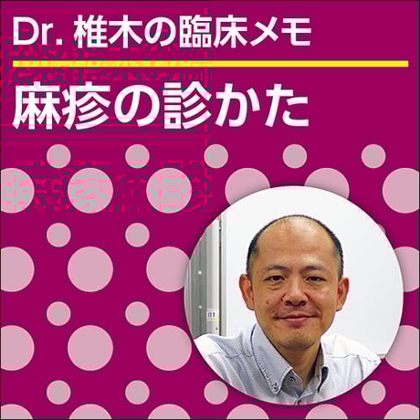 麻疹の診かた～Dr.椎木の臨床メモ