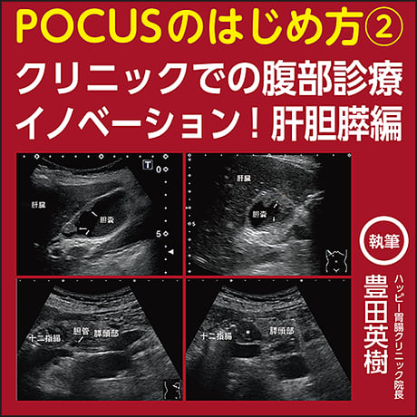 POCUSのはじめ方②〜クリニックでの腹部診療イノベーション！肝胆膵編