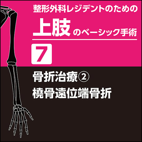 整形外科レジデントのための上肢のベーシック手術7　骨折治療2　橈骨遠位端骨折（PDF版）
