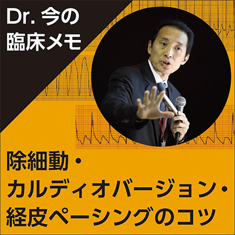 除細動・カルディオバージョン・経皮ペーシングのコツ～Dr.今の臨床メモ