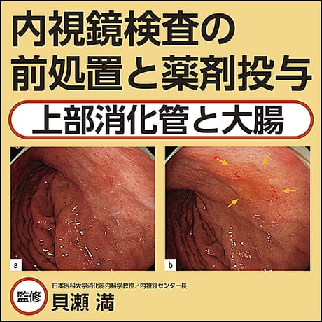 内視鏡検査の前処置と薬剤投与〜上部消化管と大腸