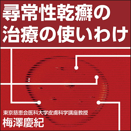 尋常性乾癬の治療の使いわけ