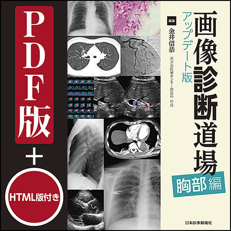 画像診断道場　アップデート版＜胸部編＞