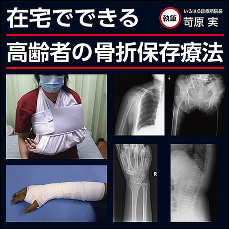 在宅でできる高齢者の骨折保存療法