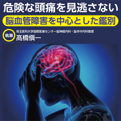 危険な頭痛を見逃さない〜脳血管障害を中心とした鑑別