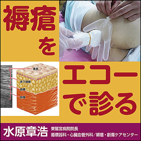 褥瘡をエコーで診る