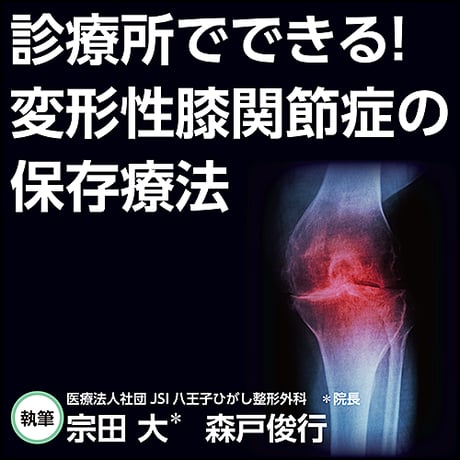 診療所でできる！変形性膝関節症の保存療法