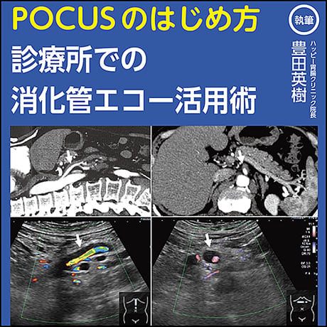 POCUSのはじめ方〜診療所での消化管エコー活用術