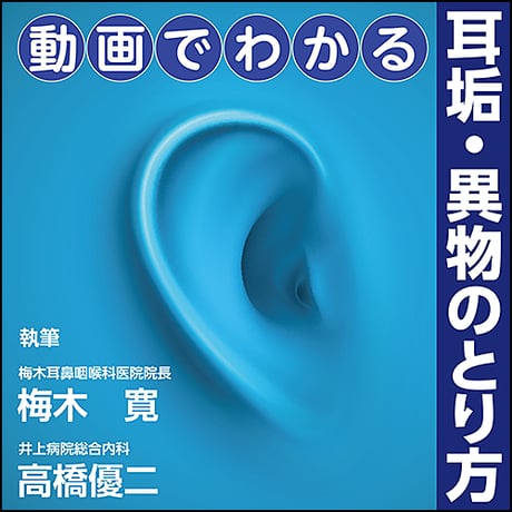 動画でわかる 耳垢・異物のとり方