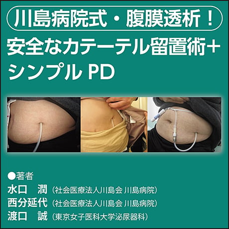 川島病院式・腹膜透析！ 安全なカテーテル留置術＋シンプルPD