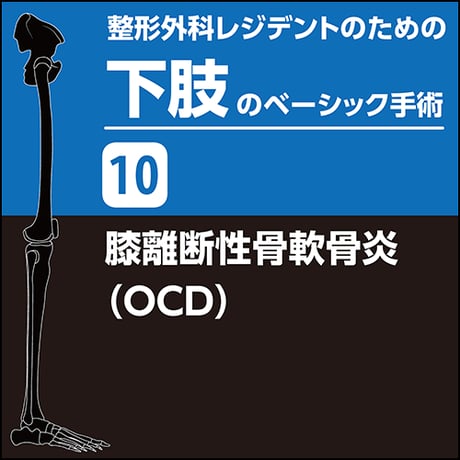 整形外科レジデントのための下肢のベーシック手術10　膝離断性骨軟骨炎（OCD）（PDF版）