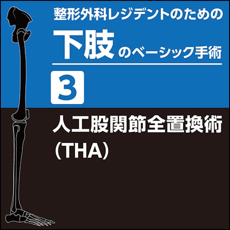 整形外科レジデントのための下肢のベーシック手術3　人工股関節全置換術（THA）（PDF版）