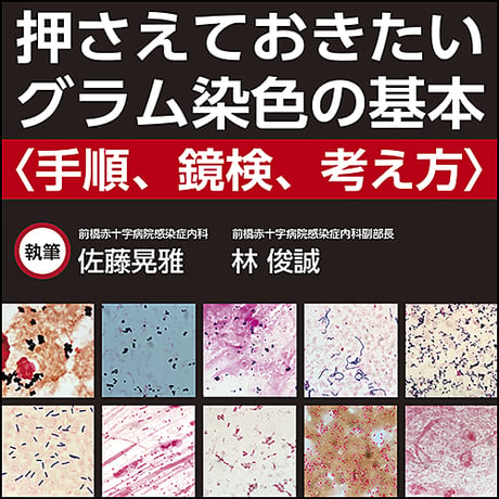 押さえておきたいグラム染色の基本～手順，鏡検，考え方