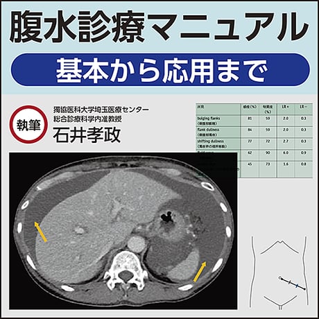 腹水診療マニュアル〜基本から応用まで