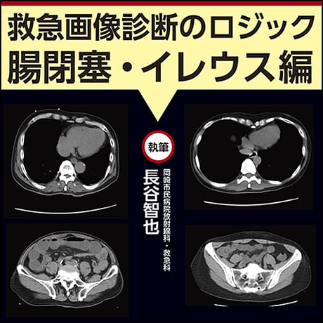 救急画像診断のロジック〜腸閉塞・イレウス編