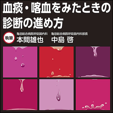 血痰・喀血をみたときの診断の進め方