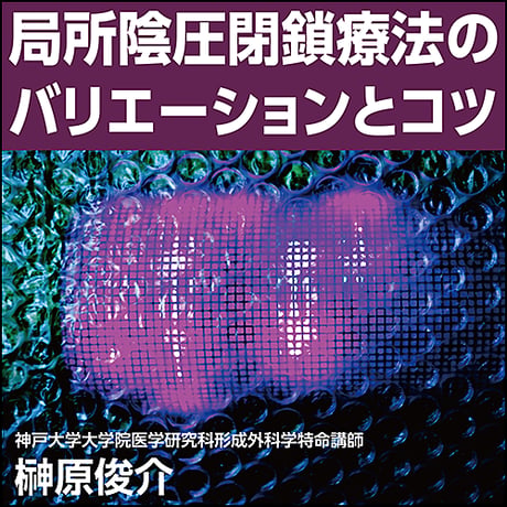 局所陰圧閉鎖療法のバリエーションとコツ