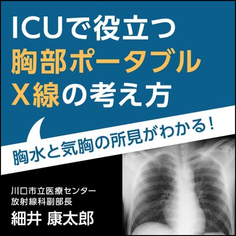 ICUで役立つ胸部ポータブルX線の考え方〈胸水と気胸の所見がわかる！〉
