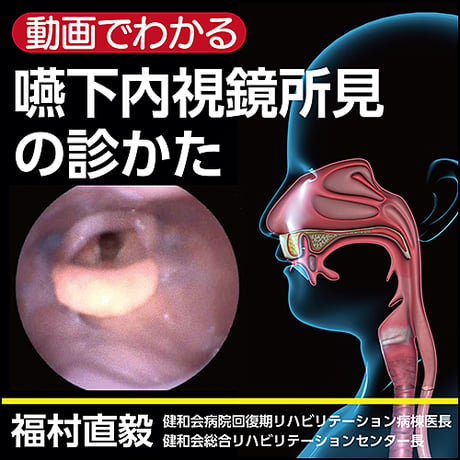 〈動画でわかる〉嚥下内視鏡所見の診かた