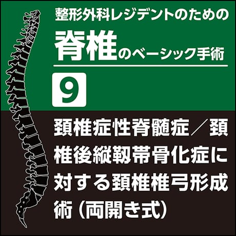 整形外科レジデントのための脊椎のベーシック手術9　頚椎症性脊髄症／頚椎後縦靱帯骨化症に対する頚椎椎弓形成術（両開き式）（PDF版）